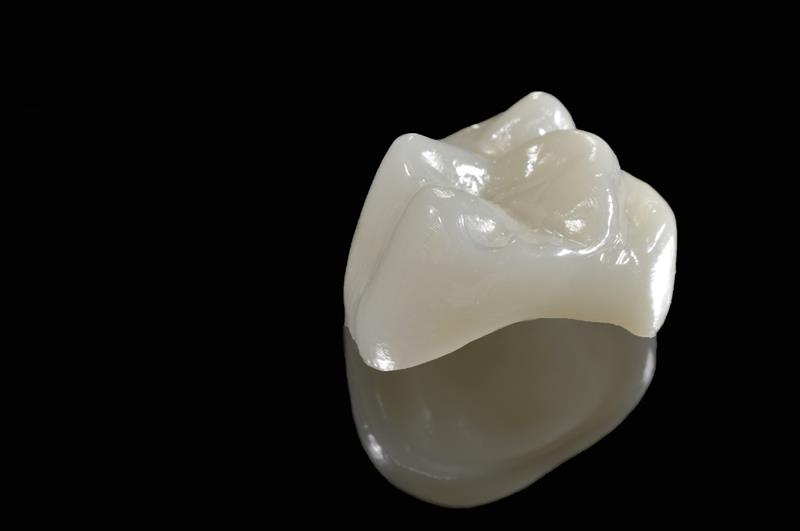 Porcelain and PFM dental crowns in Manhattan NY